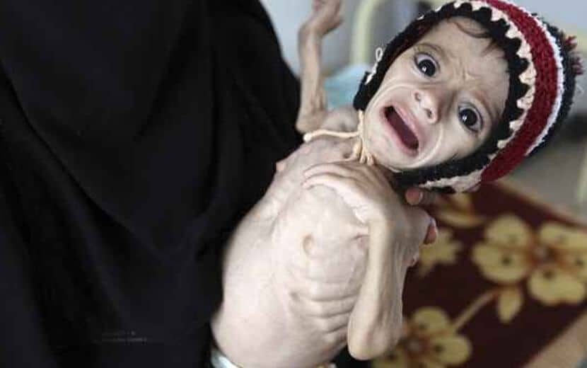 Yemen, ABD Çıkarları İçin Tarumar Edildi