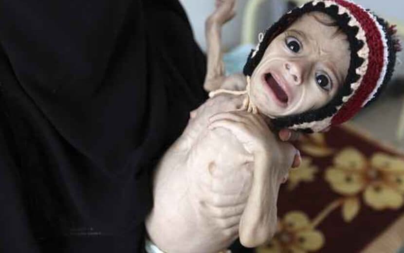 Yemen, ABD Çıkarları İçin Tarumar Edildi