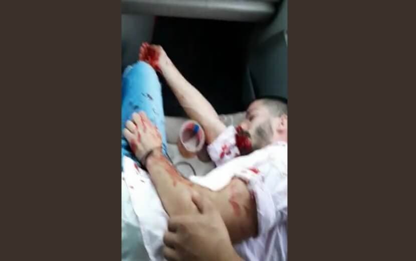 Irkçılık Virüsüne Kim Dur Diyecek!